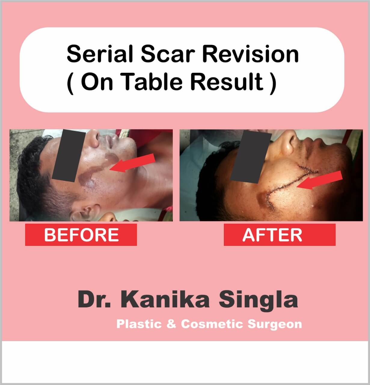 Best Cosmetic and Plastic Surgeon in Meerut