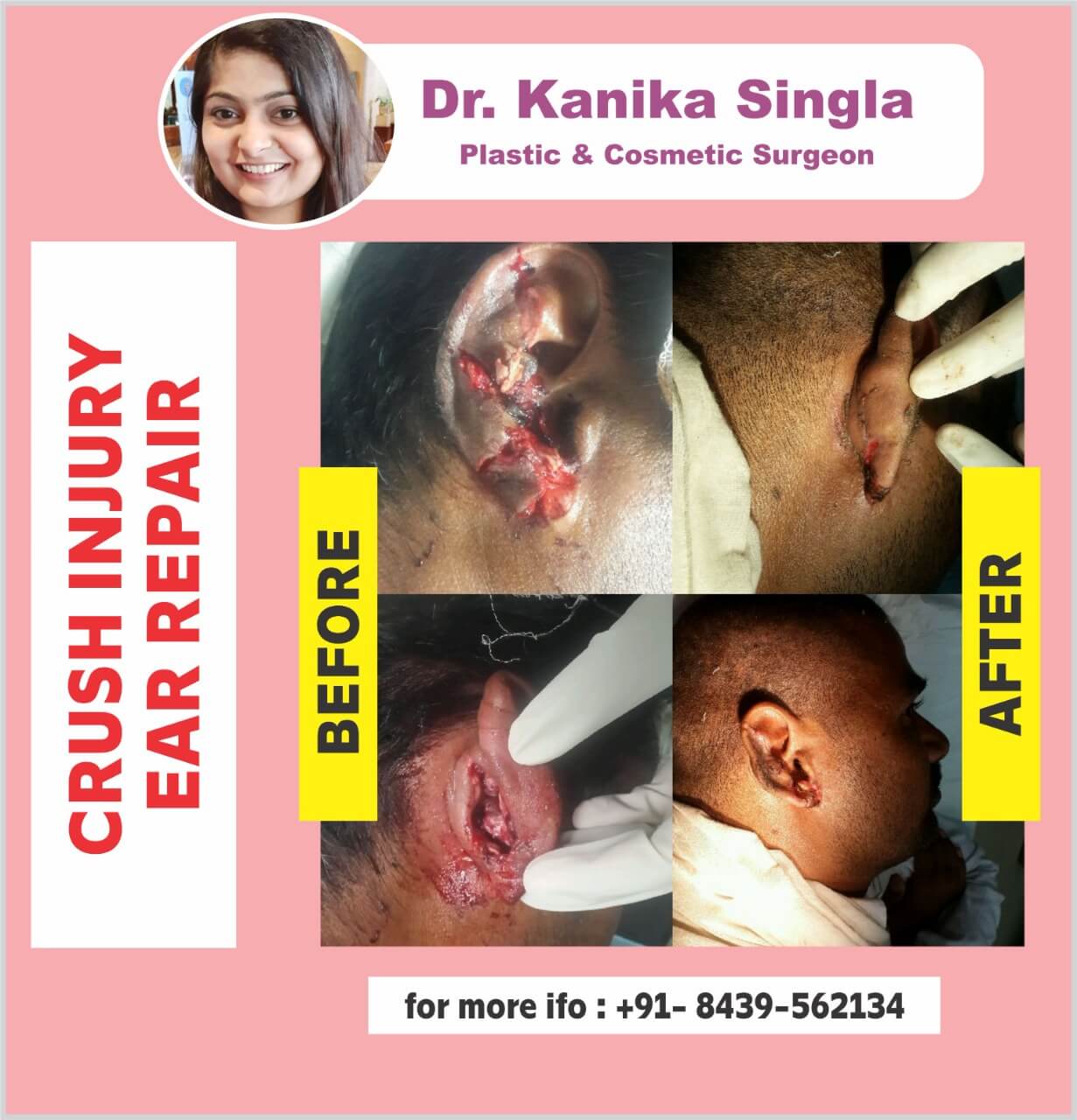 Best Cosmetic and Plastic Surgeon in Meerut