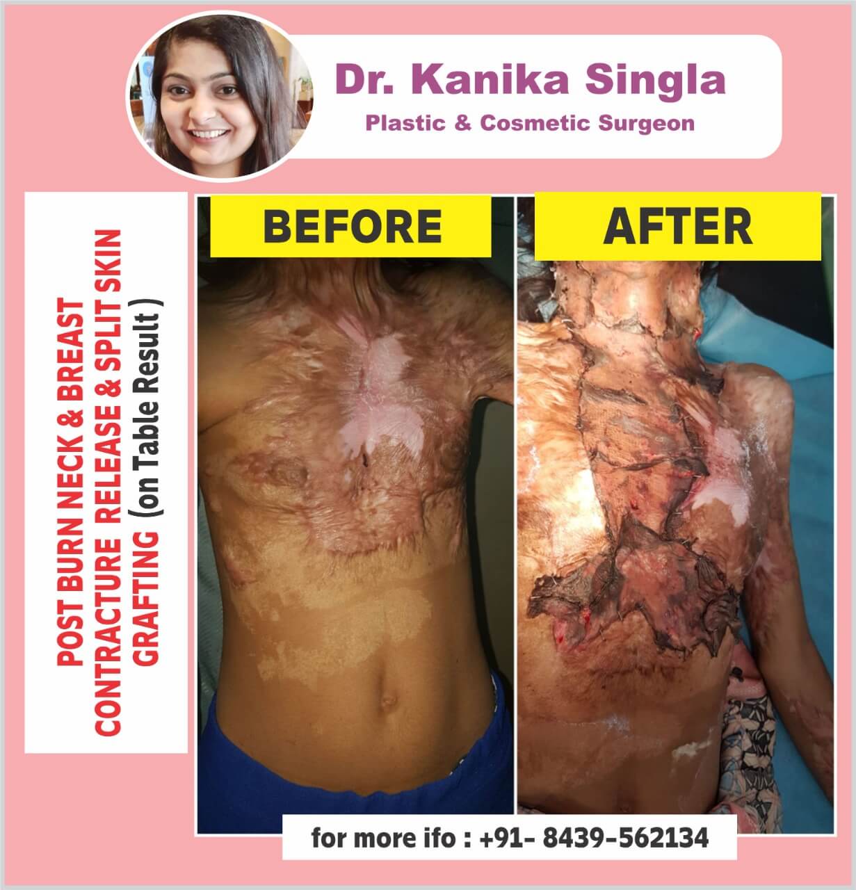 Best Cosmetic and Plastic Surgeon in Meerut