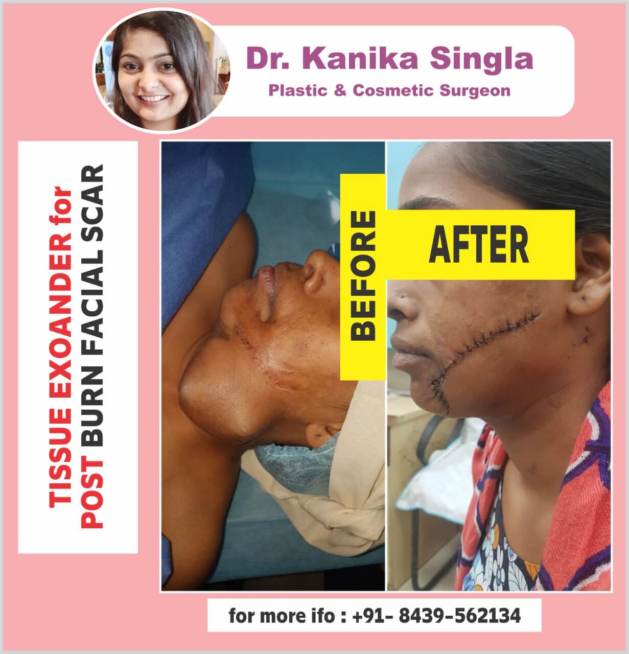 Best Cosmetic and Plastic Surgeon in Meerut