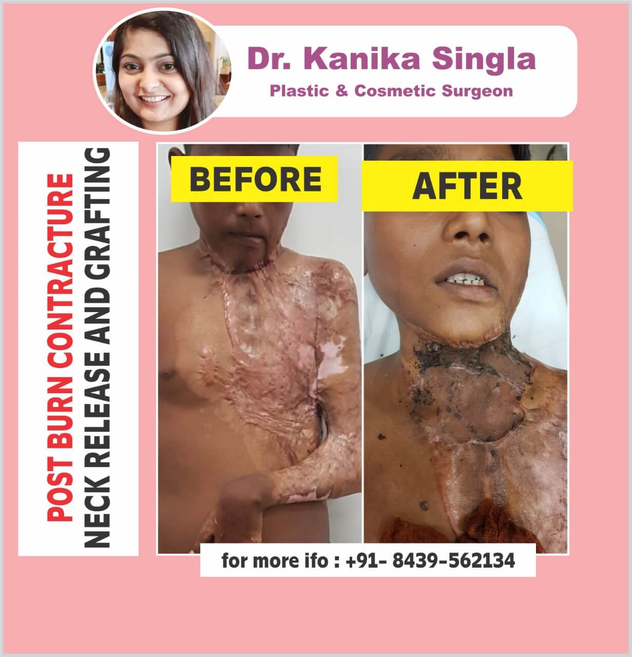 Best Cosmetic and Plastic Surgeon in Meerut