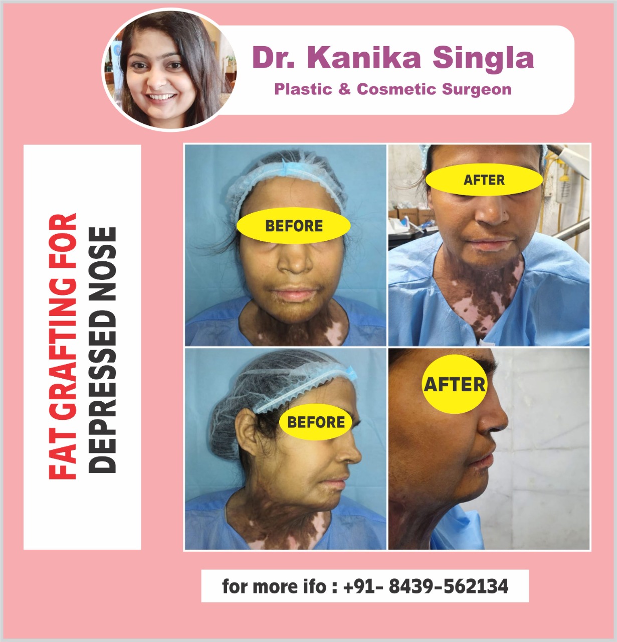 Best Cosmetic and Plastic Surgeon in Meerut