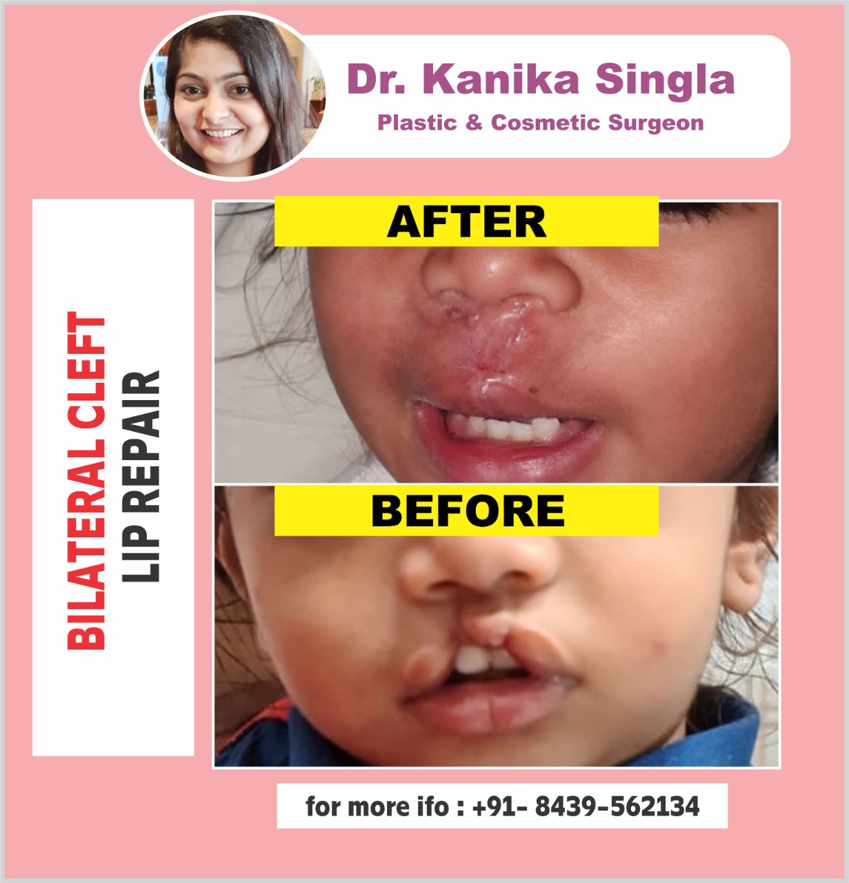 Best Cosmetic and Plastic Surgeon in Meerut