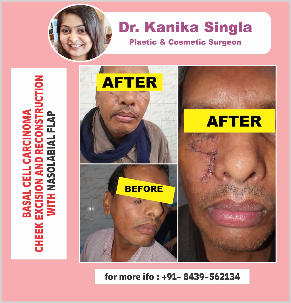 Best Cosmetic and Plastic Surgeon in Meerut