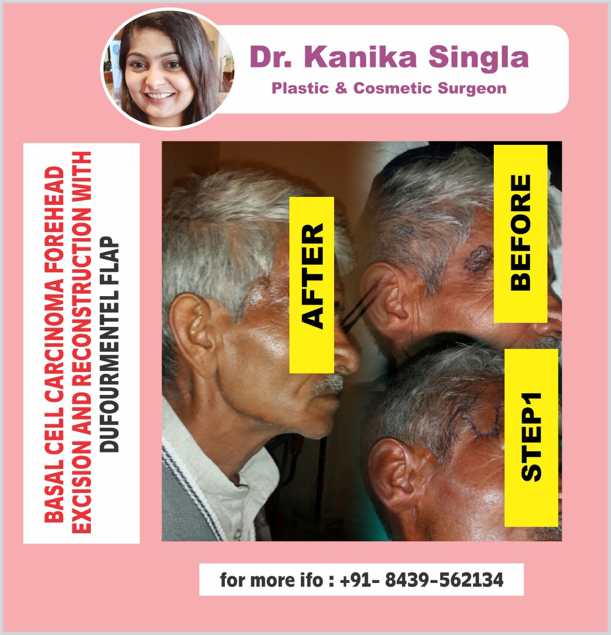 Best Cosmetic and Plastic Surgeon in Meerut