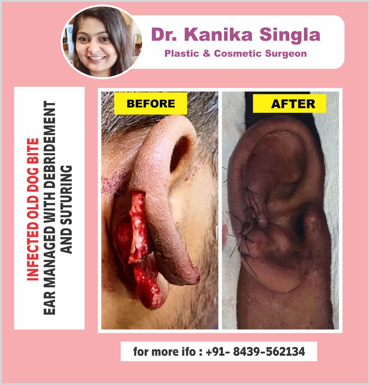 Best Cosmetic and Plastic Surgeon in Meerut