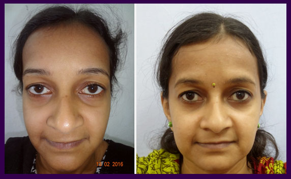 Best Cosmetic and Plastic Surgeon in Meerut