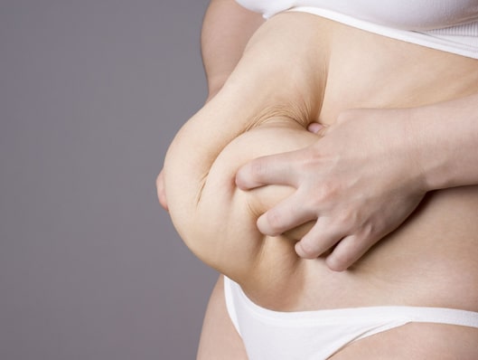 Abdominoplasty Or Tummy Tuck