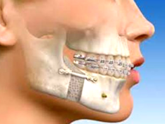 Maxillofacial, Best Cosmetic and Plastic Surgeon in Meerut