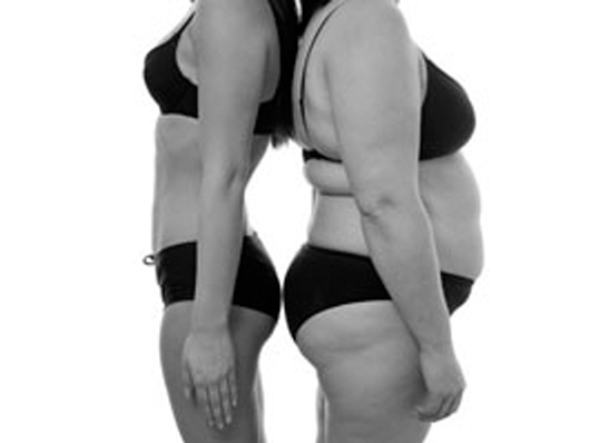 Post Bariatric Body Contouring, Best Cosmetic and Plastic Surgeon in Meerut