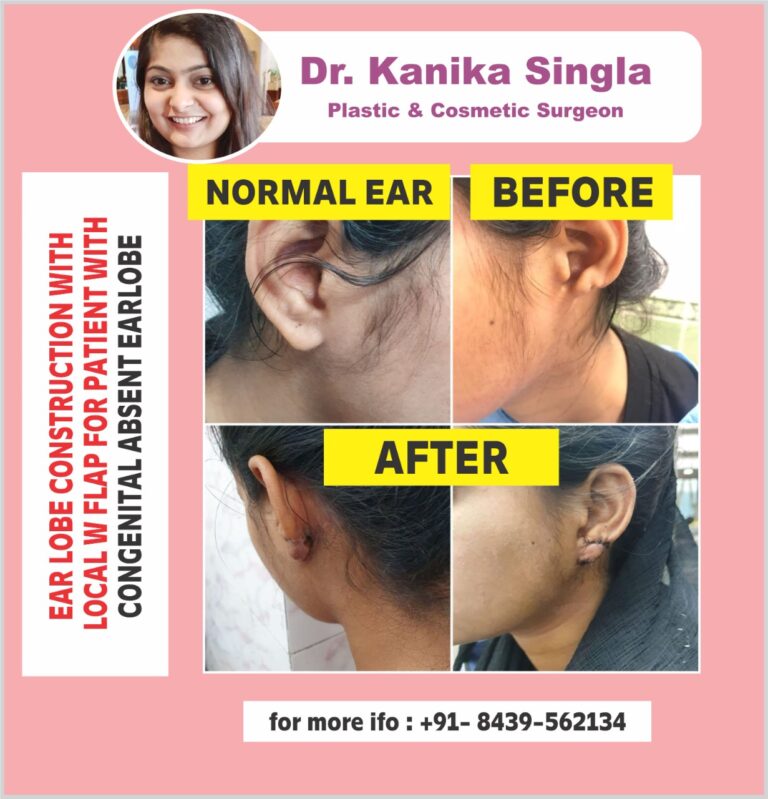 Best Cosmetic and Plastic Surgeon in Meerut