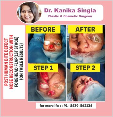 Best Cosmetic and Plastic Surgeon in Meerut