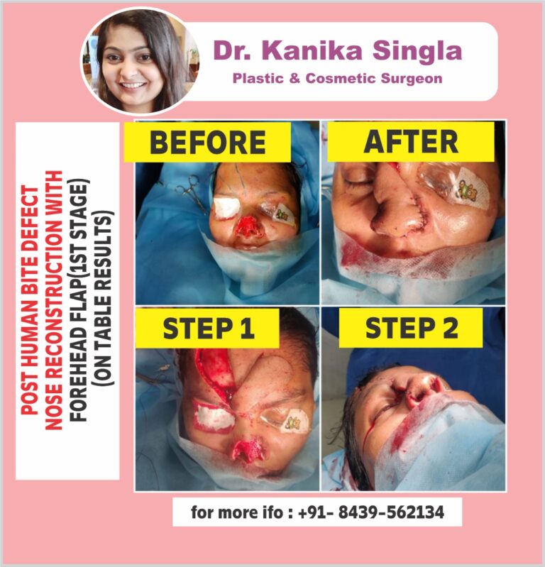 Best Cosmetic and Plastic Surgeon in Meerut