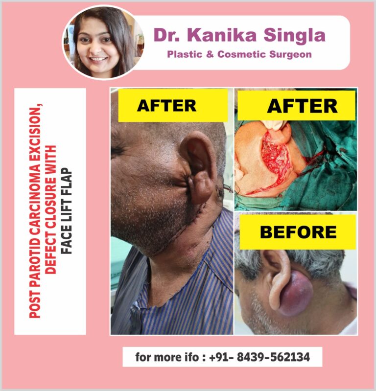 Best Cosmetic and Plastic Surgeon in Meerut