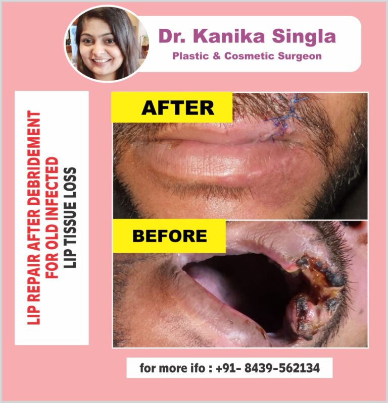 Best Cosmetic and Plastic Surgeon in Meerut