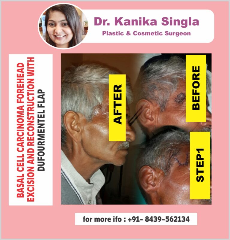 Best Cosmetic and Plastic Surgeon in Meerut