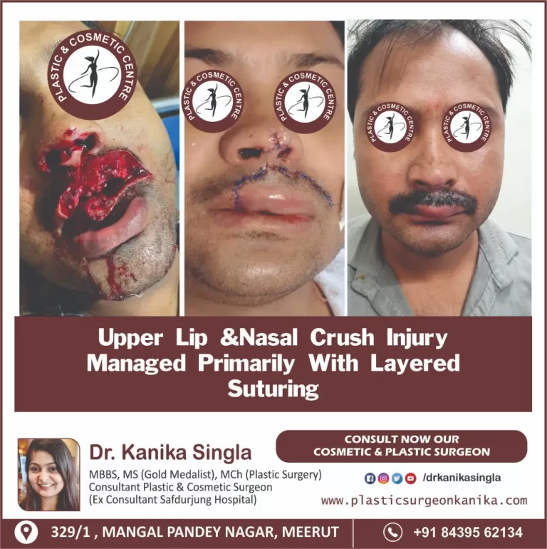 Best Cosmetic and Plastic Surgeon in Meerut