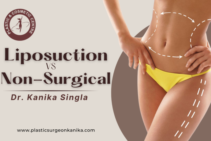 Liposuction vs. Non-Surgical Fat Reduction