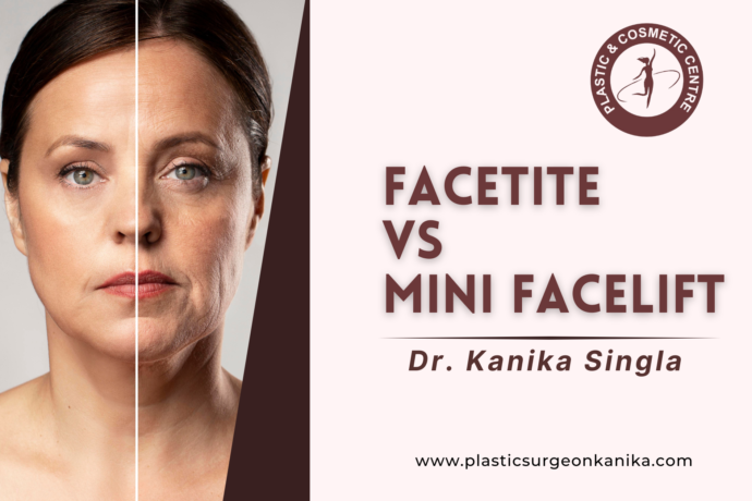 FaceTite vs Mini Facelift