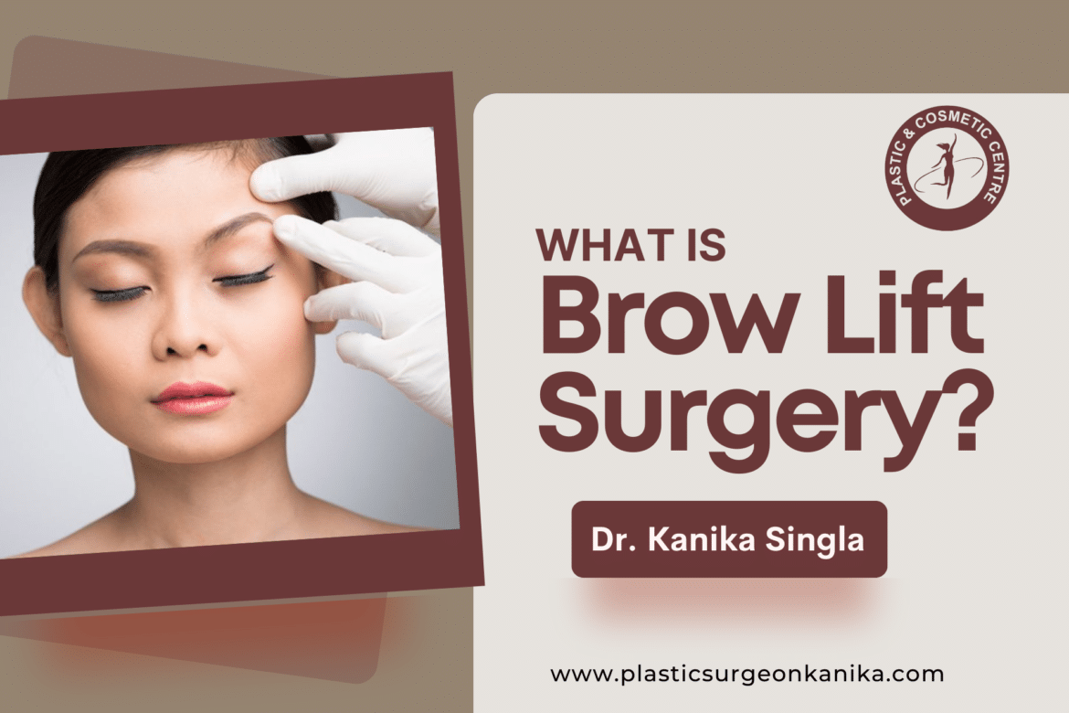 brow lift surgery