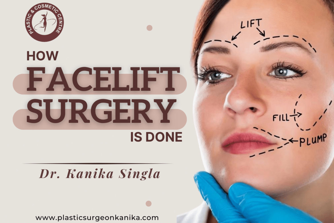 how facelift surgery is done