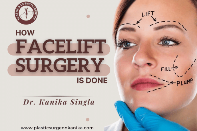 how facelift surgery is done