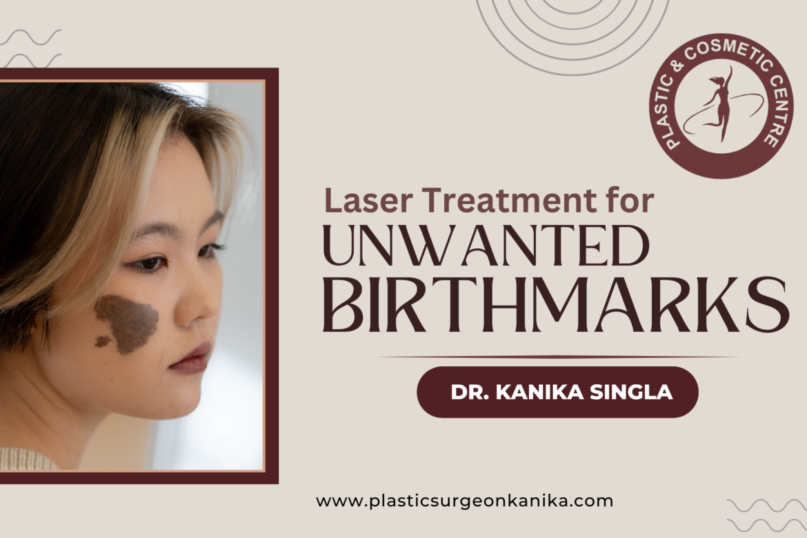 Laser Treatment for unwanted Birthmarks