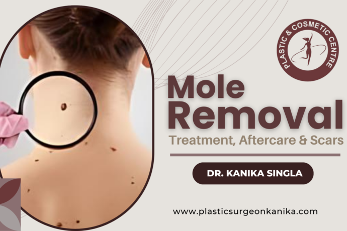 Mole Removal