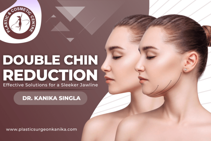 Double Chin Reduction