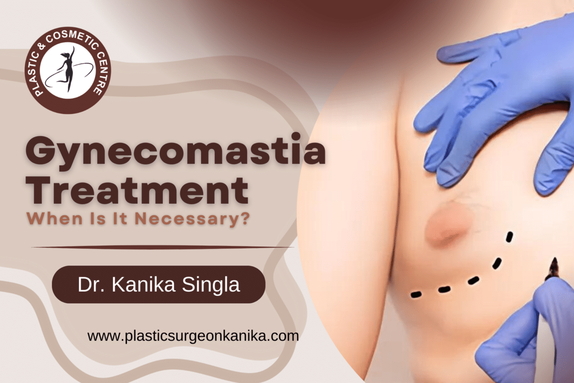 Gynecomastia Treatment