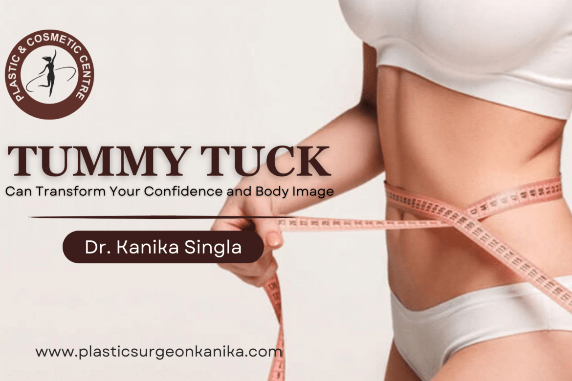 Tummy Tuck