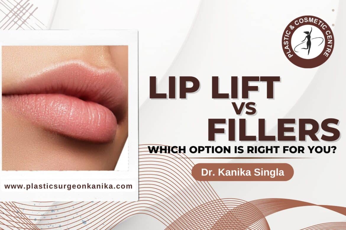 Lip Lift vs. Fillers