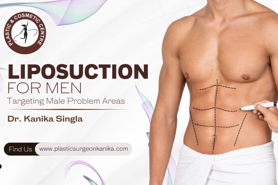 Liposuction for Men